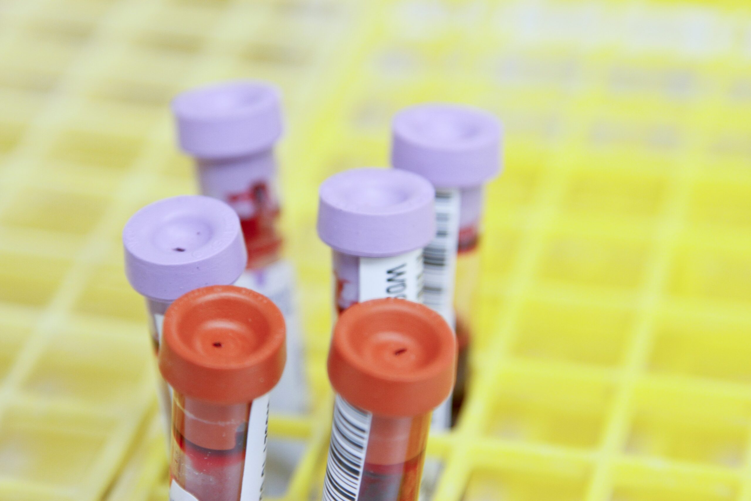 Diagnosing Blood Cancer: Tests and Procedures